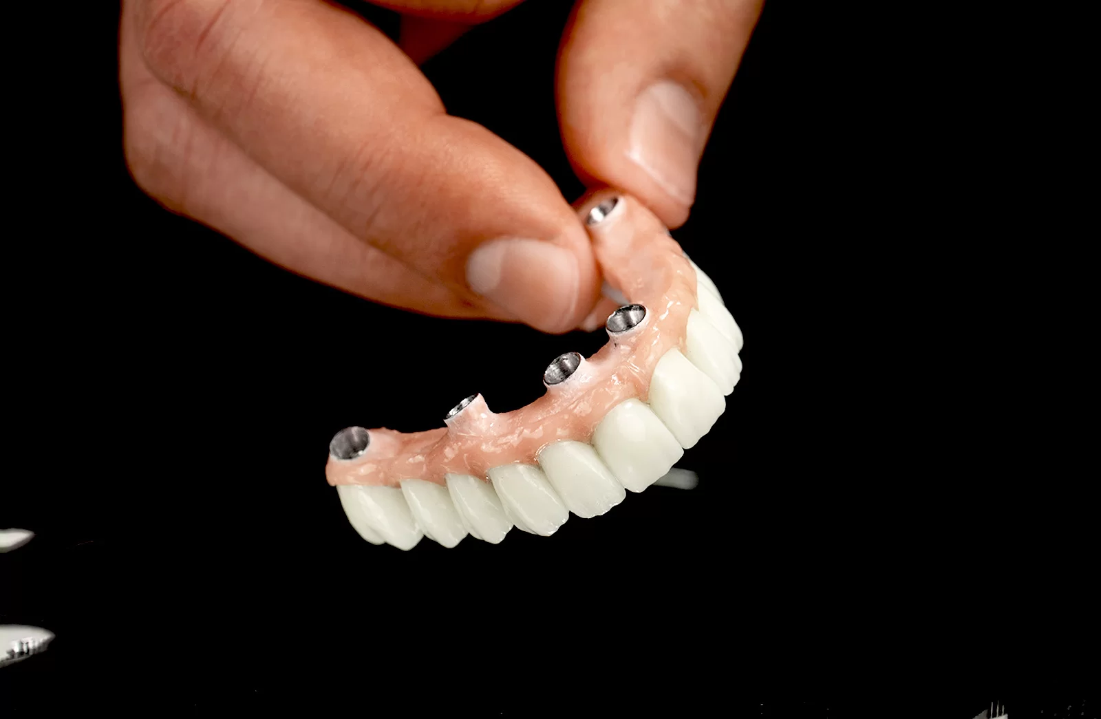 Bezzobu žokļa atjaunošana ar implantu palīdzību
